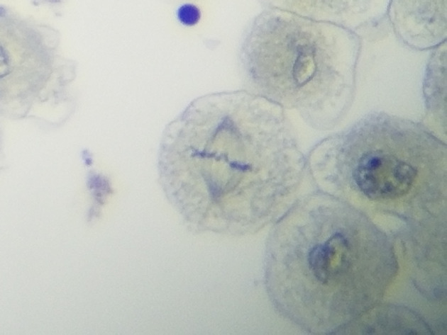 White Fish Mitosis Slides - White Fish Mitosis 17 400X